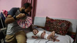Sarna e piolho se propagam nas crianças em Gaza 
